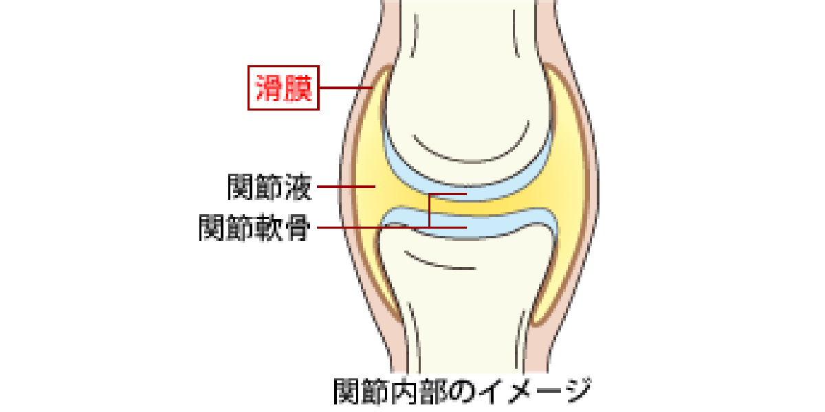 湿疹とは？