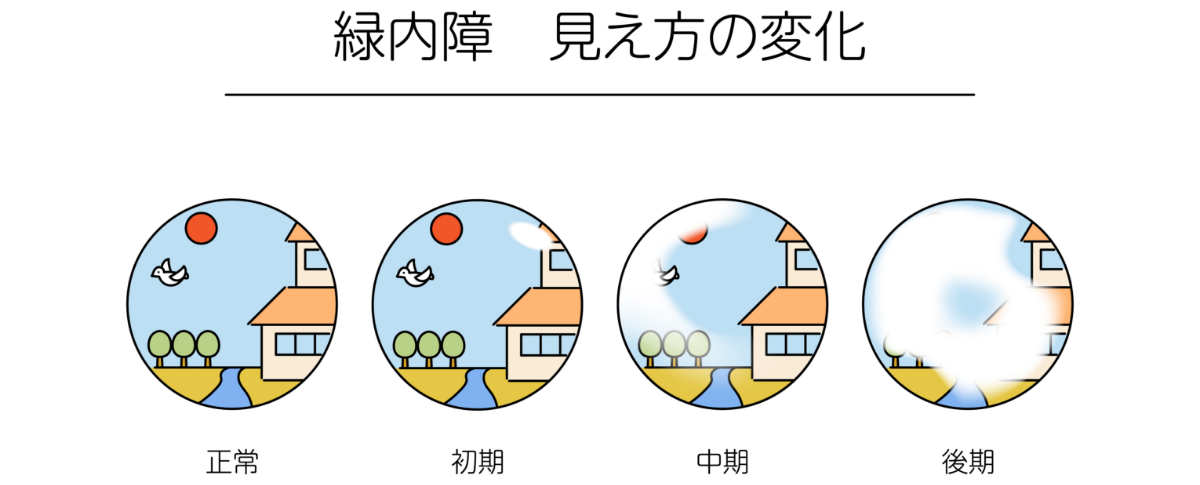 湿疹の症状