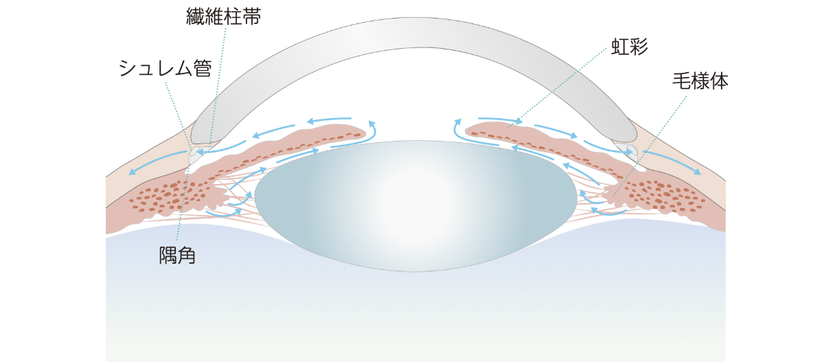 緑内障の原因