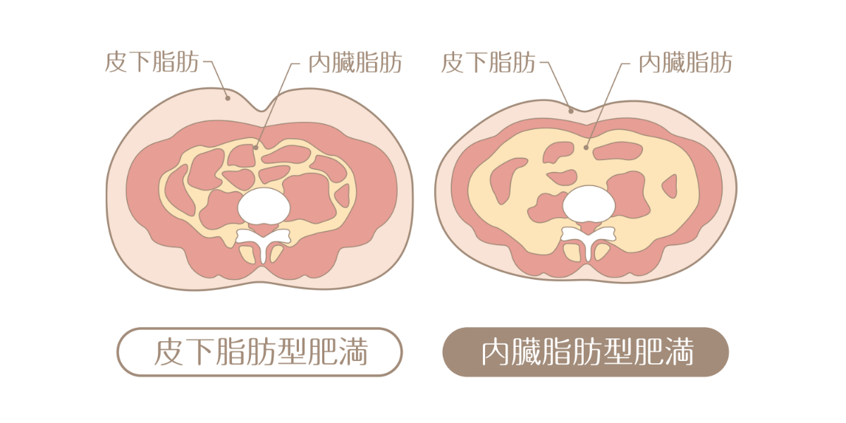 内臓脂肪と皮下脂肪の違い